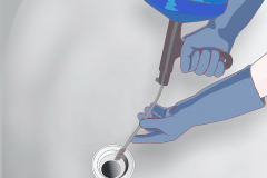 Lavabo Tıkanıklığı Ankara